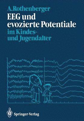 Aribert Rothenberger - EEG und evozierte Potentiale im Kindes- und Jugendalter, Häftad