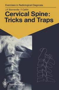 bokomslag Cervical Spine: Tricks and Traps