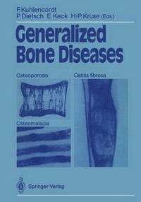 bokomslag Generalized Bone Diseases
