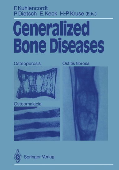Friedrich Kuhlencordt, Peter Dietsch, Elmar Keck, Hans-Peter Kruse - Generalized Bone Diseases, Häftad