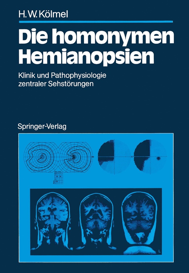 Hans W. Kölmel - Die homonymen Hemianopsien, Häftad