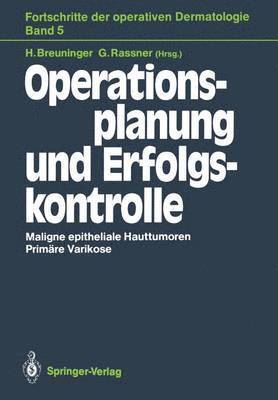 bokomslag Operationsplanung und Erfolgskontrolle