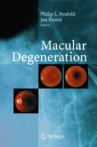 bokomslag Macular Degeneration