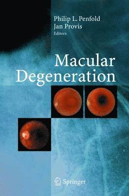 Macular Degeneration 1