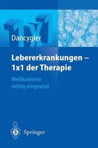 bokomslag Lebererkrankungen 1¿1 der Therapie