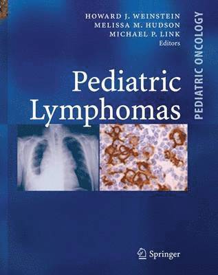 bokomslag Pediatric Lymphomas