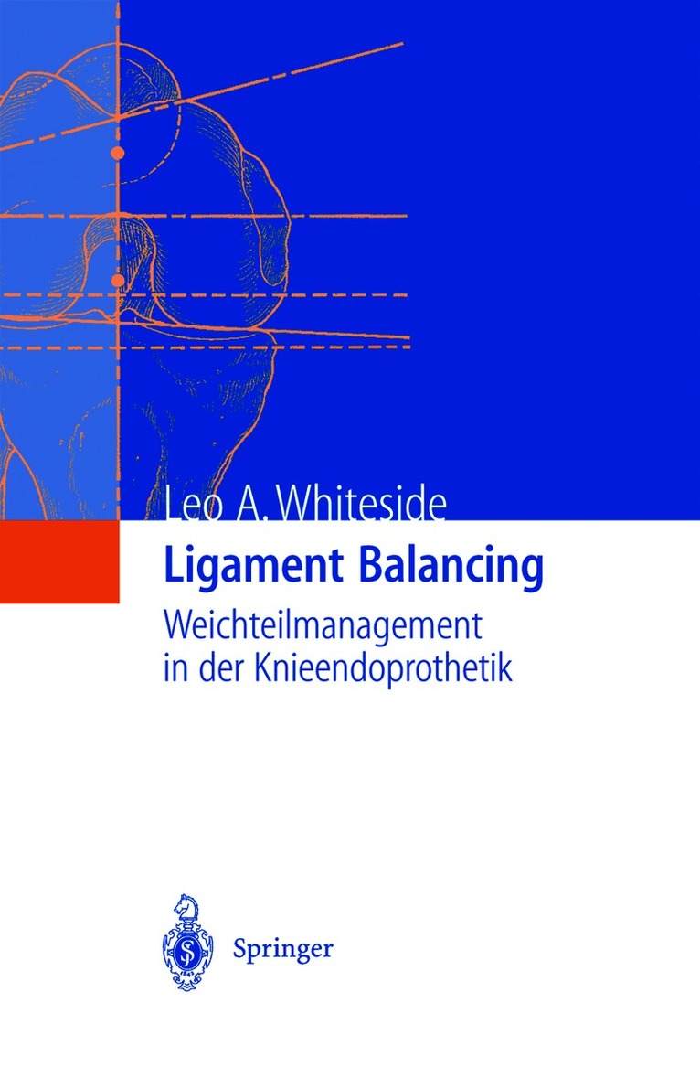 Leo A. Whiteside - Ligament Balancing, Inbunden