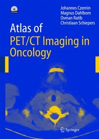 bokomslag Atlas of Pet/Ct Imaging in Oncology: Atlas of PET