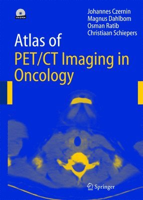 Atlas of Pet/Ct Imaging in Oncology: Atlas of PET 1