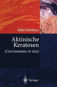 bokomslag Aktinische Keratosen (Carcinomata in situ)
