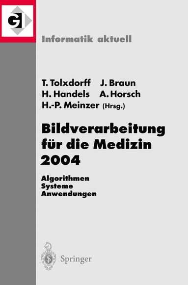 Thomas Tolxdorff, Jürgen Braun, Heinz Handels, Alexander Horsch, Hans-Peter Meinzer - Bildverarbeitung für die Medizin 2004, Häftad