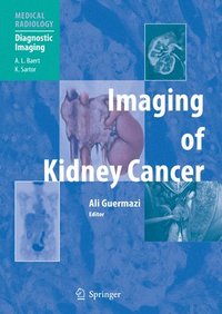 bokomslag Imaging of Kidney Cancer