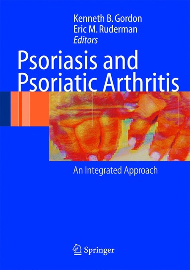 bokomslag Psoriasis and Psoriatic Arthritis