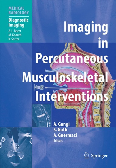 bokomslag Imaging in Percutaneous Musculoskeletal Interventions