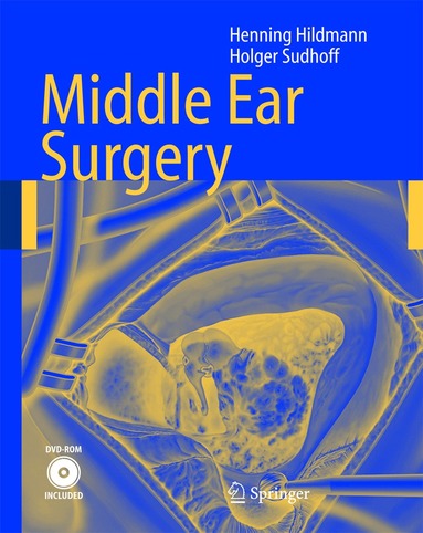 Henning Hildmann, Holger Sudhoff - Middle Ear Surgery, Inbunden
