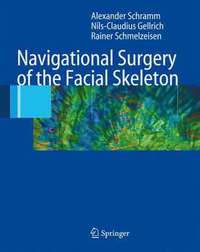 bokomslag Navigational Surgery of the Facial Skeleton