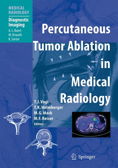 Thomas J. Vogl, Thomas Helmberger, Martin G. Mack, Maximilian F Reiser - Percutaneous Tumor Ablation in Medical Radiology, Inbunden