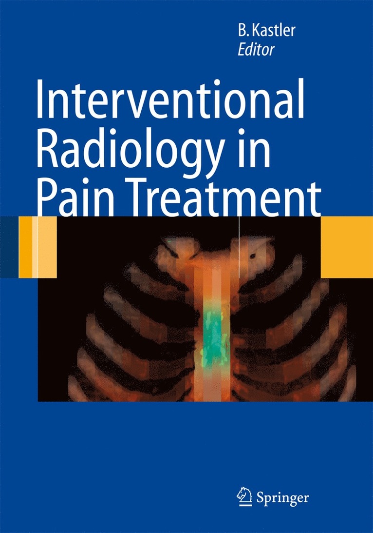 Interventional Radiology in Pain Treatment 1