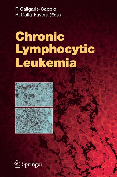 bokomslag Chronic Lymphocytic Leukemia