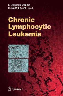 Caligaris-Cappio - Chronic Lymphocytic Leukemia, Inbunden