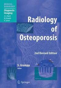 bokomslag Radiology of Osteoporosis