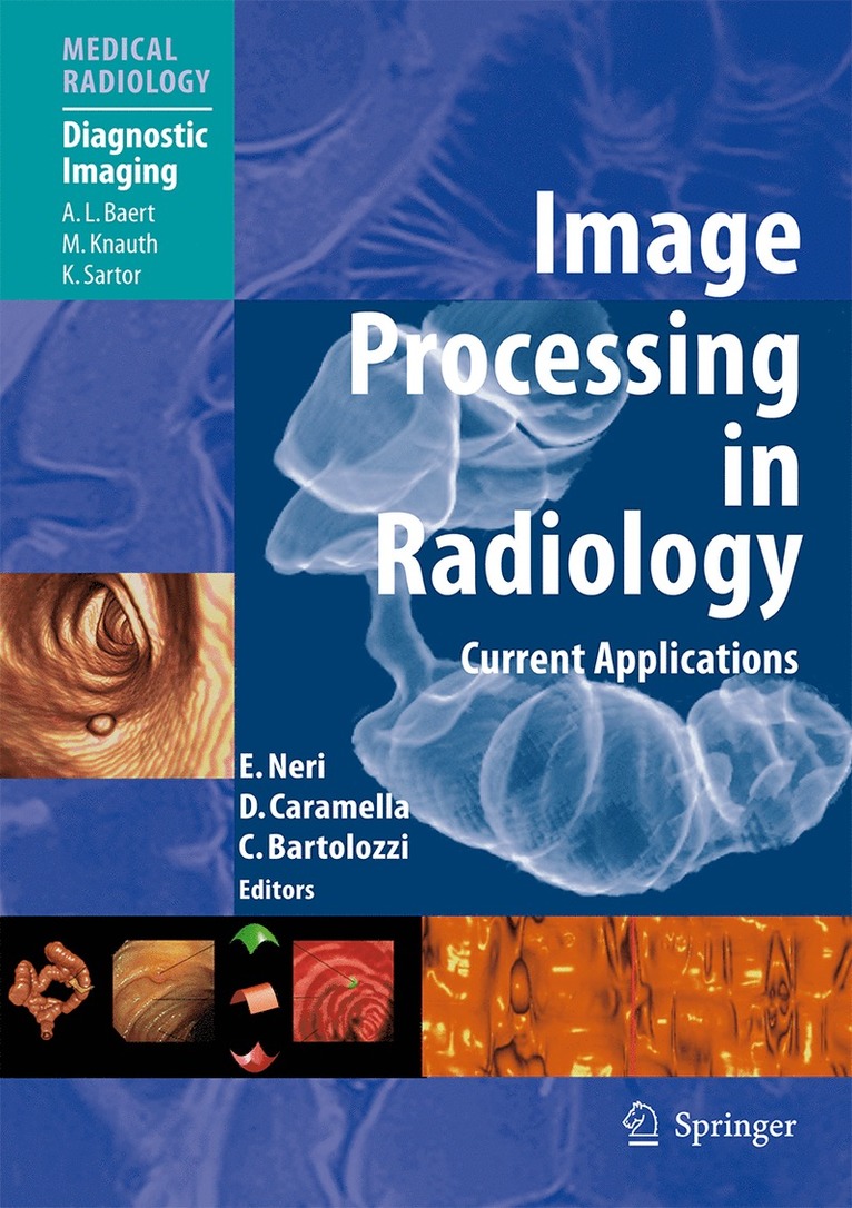 Emanuele Neri, Davide Caramella, Carlo Bartolozzi - Image Processing in Radiology, Inbunden
