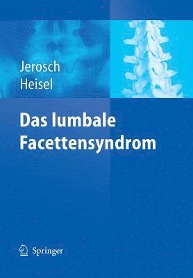 Jörg Jerosch, Jürgen Heisel, Jorg Jerosch, Jurgen Heisel - Das lumbale Facettensyndrom, Häftad