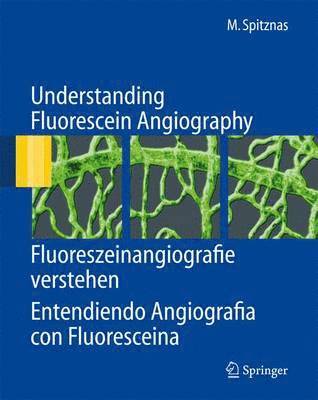 bokomslag Understanding Fluorescein Angiography, Fluoreszeinangiografie verstehen, Entendiendo Angiografía con Fluoresceína