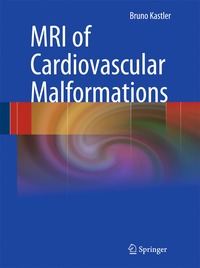 bokomslag MRI of Cardiovascular Malformations