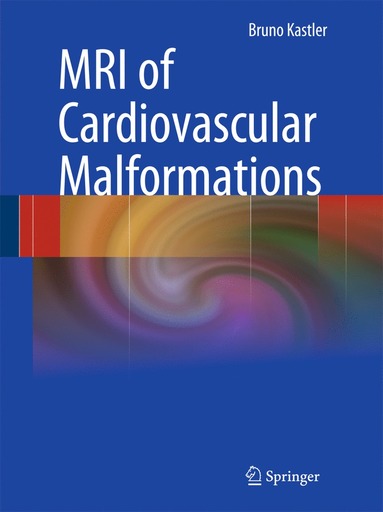 bokomslag MRI of Cardiovascular Malformations