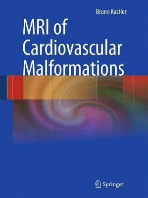 MRI of Cardiovascular Malformations 1