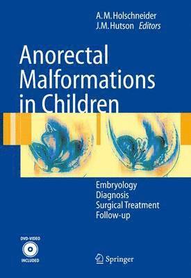 bokomslag Anorectal Malformations in Children