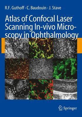 bokomslag Atlas of Confocal Laser Scanning In-vivo Microscopy in Ophthalmology