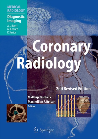 Matthijs Oudkerk, Maximilian F Reiser - Coronary Radiology, Inbunden