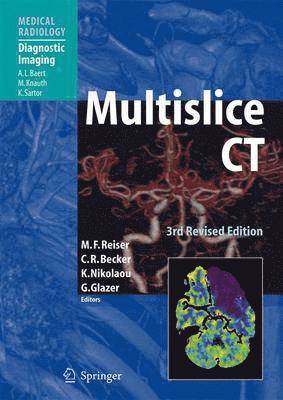 Multislice CT 1