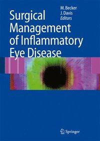 bokomslag Surgical Management of Inflammatory Eye Disease