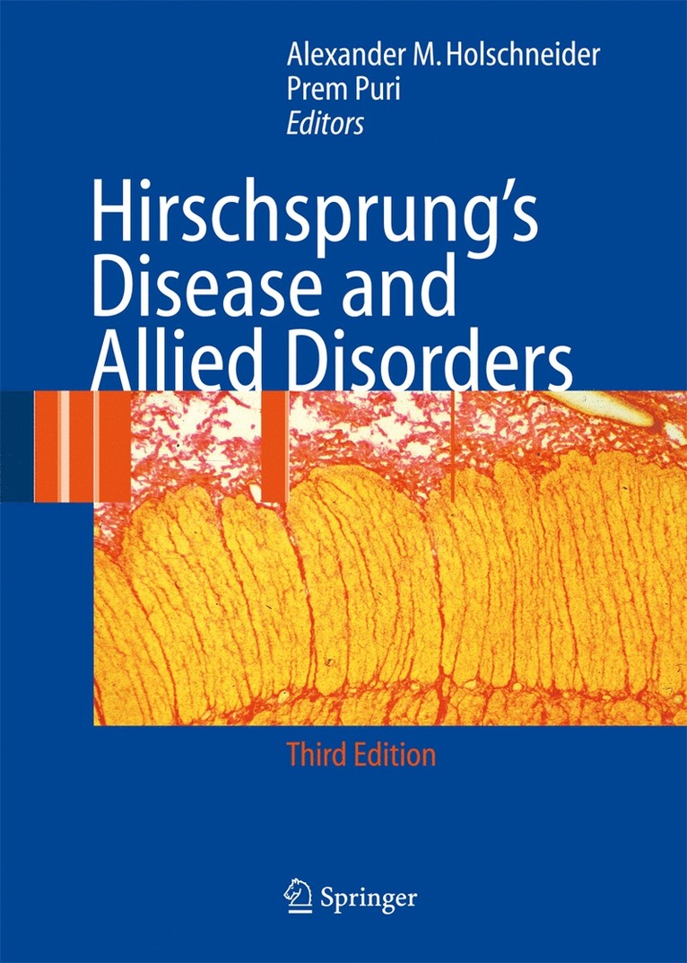 Alexander Matthias Holschneider, Prem Puri - Hirschsprung's Disease and Allied Disorders, Inbunden