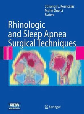 Rhinologic and Sleep Apnea Surgical Techniques 1