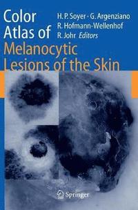 bokomslag Color Atlas of Melanocytic Lesions of the Skin