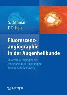 bokomslag Fluoreszenzangiographie in der Augenheilkunde