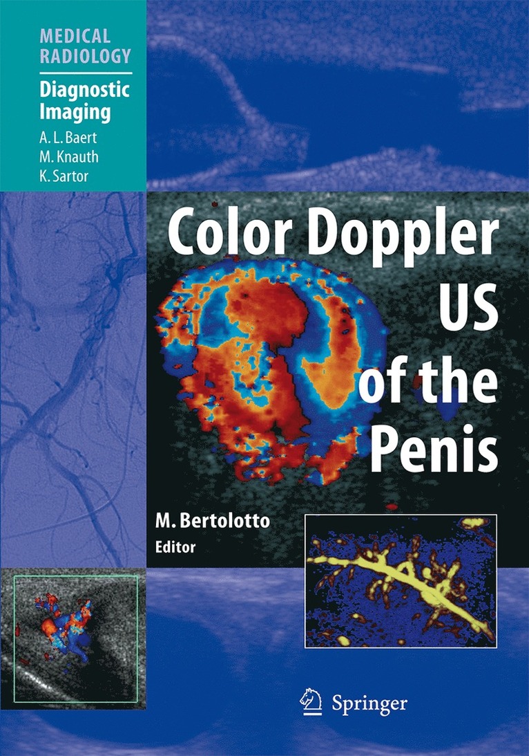 Color Doppler US of the Penis