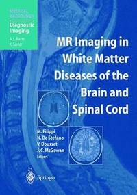 bokomslag MR Imaging in White Matter Diseases of the Brain and Spinal Cord