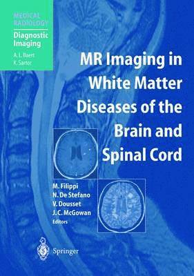 MR Imaging in White Matter Diseases of the Brain and Spinal Cord 1