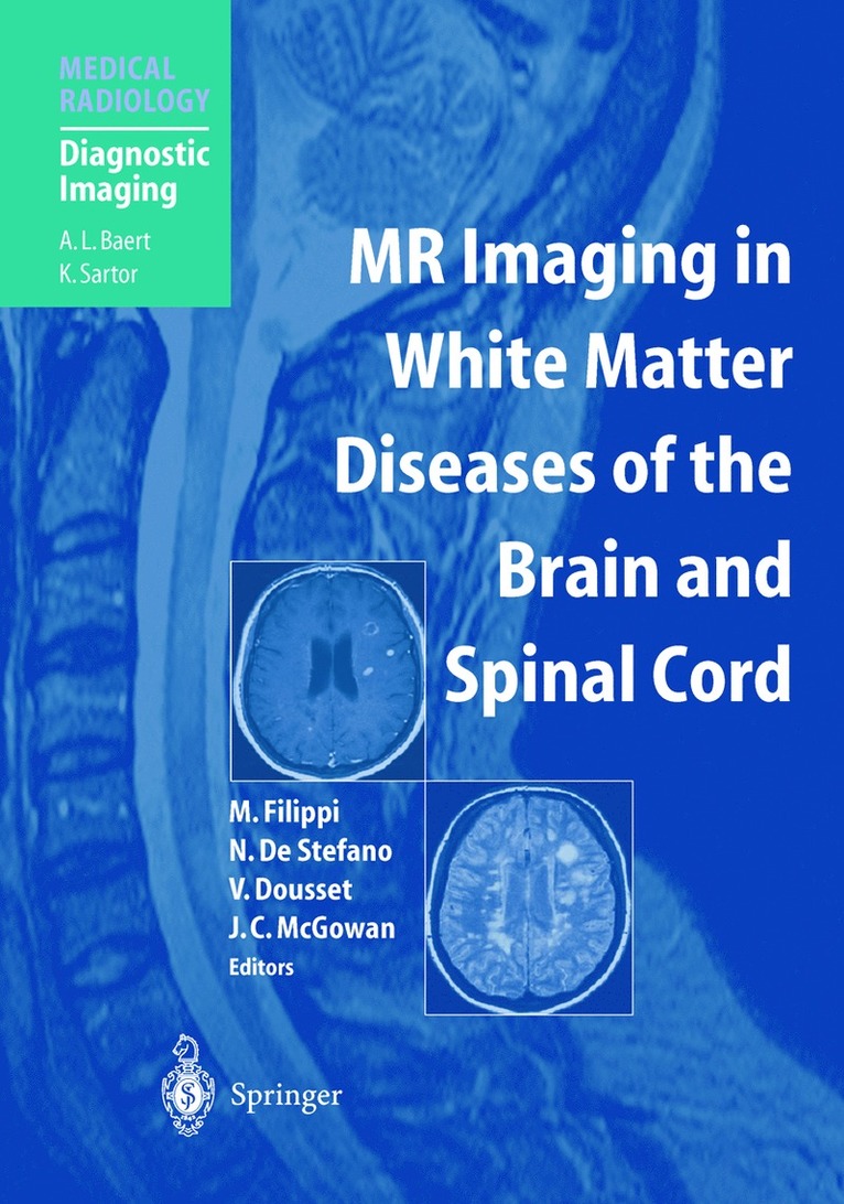 M. Filippi, Massimo Filippi, Nicola de Stefano, Vincent Dousset, Joseph C. McGowan, Nicola De Stefano - MR Imaging in White Matter Diseases of the Brain and Spinal Cord, Inbunden
