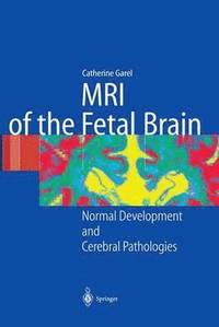 bokomslag MRI of the Fetal Brain