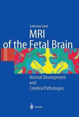 MRI of the Fetal Brain 1