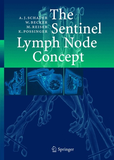 Alfred Schauer, Wolfgang Becker, Maximilian F Reiser, Kurt Possinger - Sentinel Lymph Node Concept, Inbunden