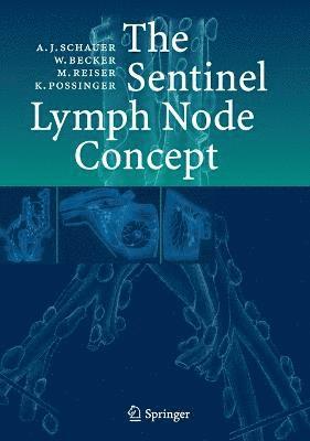 The Sentinel Lymph Node Concept 1