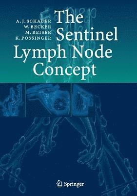 Sentinel Lymph Node Concept 1