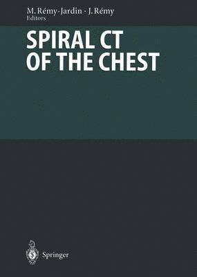 bokomslag Spiral CT of the Chest